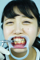 歯 観察 後藤 まりか