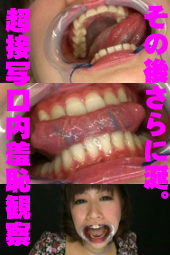 八重歯の可愛い【ひとみちゃん】口内観察・唾・えずき汁