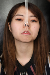 【急展開!?】ハウスダスト症候群・動物アレルギーの奈柚ちゃんのクシャミ&鼻観察は一体どうなる?!