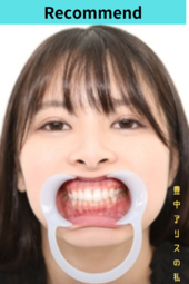 歯美少女アリスの歯観察【特典：のどちんこ鑑賞】