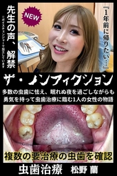 【歯科治療作品】虫歯多数発見で恐怖に怯える蘭ちゃん。。。決死の虫歯治療‼これはまさに歴史的に言うと〖松野の乱〗だぁ!!!