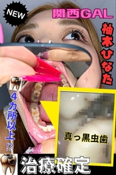 【歯医者案件】ガチでヤバい歯⁉関西『歯』ガールズコレクションでぶっちぎり優勝のGAL口内