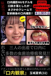 多数の治療痕＆フルクラウンみ～っけ！リアル人妻 夏帆さんのエロすぎた口内【2025年未公開作品vol.2】