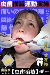 【虫歯治療】口内観察で虫歯発見⁉診察で予想以上の虫歯の深さに絶句！麻酔で失神寸前‼