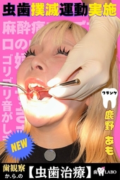 【虫歯治療】天然歯に刻まれた黒印‼ゆるふわましゅまろボディGAL鹿野あもちゃんの初虫歯治療