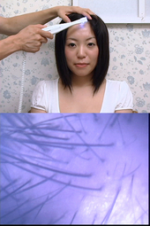 彼女の毛・毛抜きと頭皮