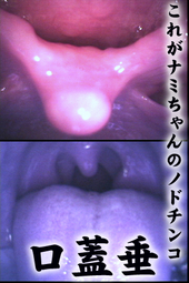 ナミちゃんの歯とのどちんこ観察