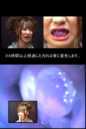 美女の歯 観察映像