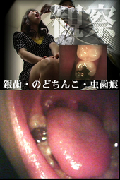 【口内観察】美女4名診察■口内事情【銀歯・のどちんこ・虫歯痕】