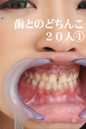 「歯とのどちんこ20人④」データ写真集