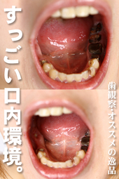 歯観察 写真付「カレンちゃん編」オススメの逸品!!