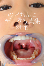 美女の「のどちんこ」データ写真集2 24名分!