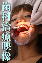 歯科治療「RISA」篇