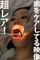歯科治療映像 ねねサン編