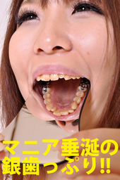 銀歯!歯観察「ゆずチャン編」