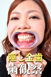 美女の歯観察 えりなサン編 データ写真31枚!