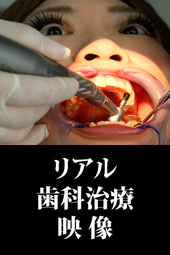 歯!レア歯科治療映像「まみ」チャン編