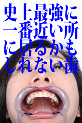 壮絶な、マダムゆかりの歯観察