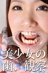 優子の歯、観察「美しき銀歯」