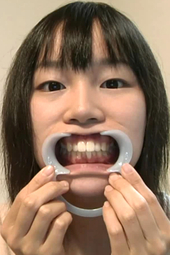素朴な感じの娘の歯石除去!フルハイビジョン