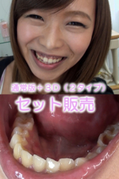 小田エリナちゃんの歯・口内自撮り(通常版+3D)