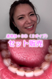 はるかちゃんの口内・矯正歯観察(通常版+3D)